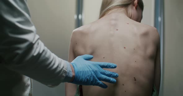 Dermatologist Examines the Patient's Moles and Marks the Ones to Be Removed