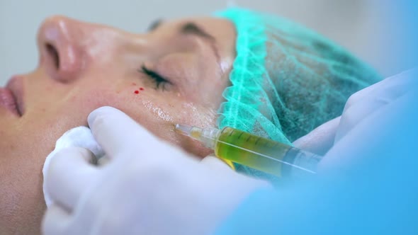 Picture of Woman Getting Botox Injection Under Her Eyes Lying with Closed Eyes in Medical Hat in alt