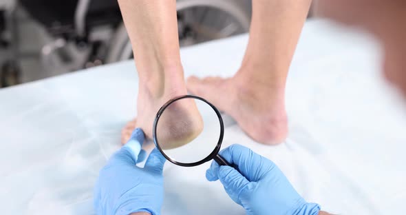 Dermatologist Conducts Physical Examination of Skin of Legs Through Magnifying Glass alt