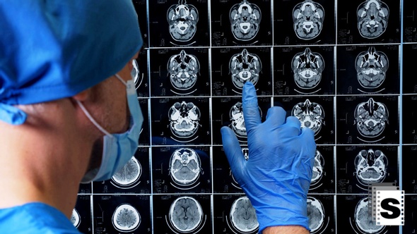 Surgeon Checking MRI