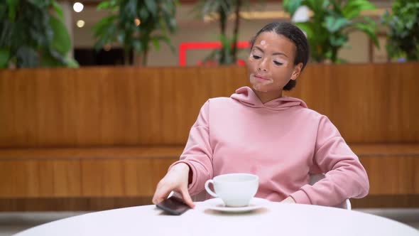 Black African American Woman with Vitiligo Pigmentation Skin Problem Indoor Dressed Pink Hoodie alt