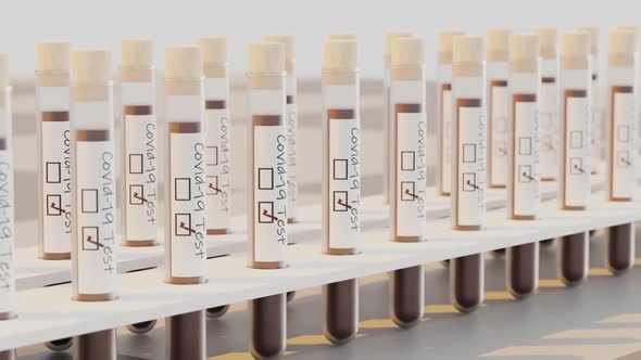 Doctor Video Footage - Test Tubes On Test Tube Racks