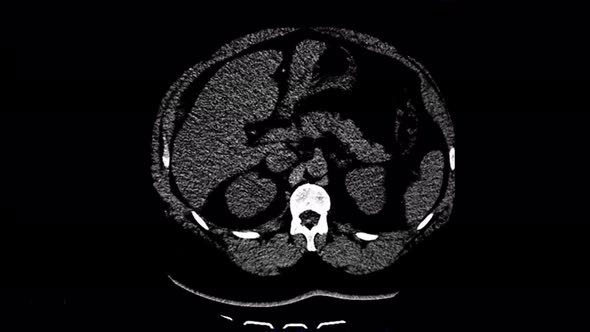 MRI Diagnostic Ultrasound View Examination Visualization Animation alt