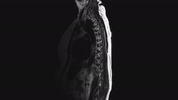 Postoperative Voluminous MRI of Female Organs for the Detection of Metastases alt