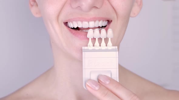 Perfect White Teeth Close Up with Shade Guide Bleach Color Female Veneer Smile Dental Care and alt