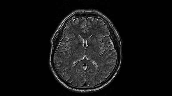 Voluminous MRI Scans of the Brain and Head To Detect Tumors. Diagnostic Medical Tool alt
