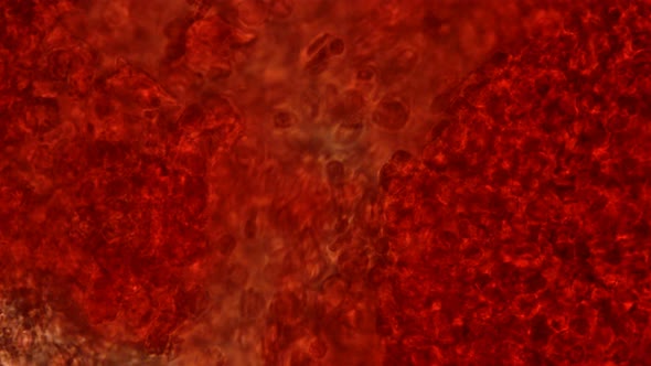 Blood Under a Microscope, the Movement of Red Blood Cells, Cells That Carry Oxygen Throughout the alt