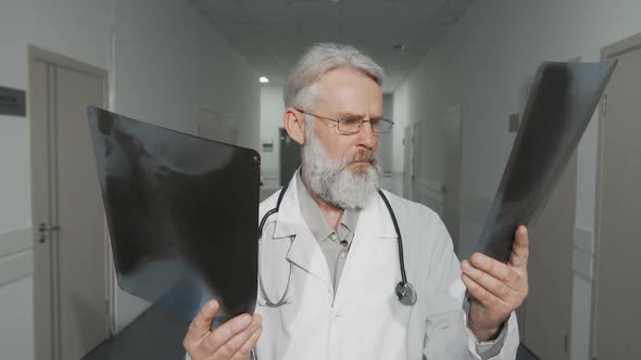 Cheerful Senior Male Doctor Smiling To the Camera While Comparing Two X-ray Scans