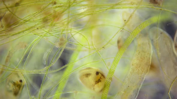 There are many different microorganisms in a drop of water under a microscope alt