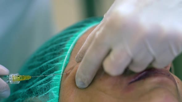 Adult Woman Lying on Medical Bed Getting Injections of Botox Into Face for Smoothing By Doctor in alt