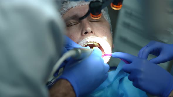 Closeup Drilling Ill Tooth in Dental Clinic in Slow Motion alt