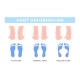 Foot Deformation Medical Poster 