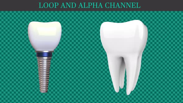 Dental Implants Loop 2x1