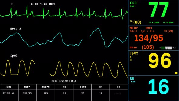 Interface Of ECG System Monitoring Health Condition Of Patients Heart Organ alt
