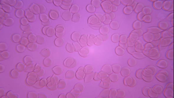 Microscopy: Human Blood. Blood Clots Under Microscope 01
