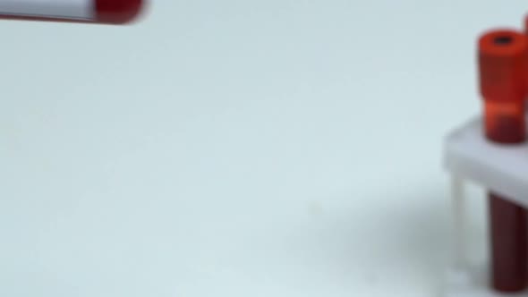 N Meningidis, Doctor Holding Blood Sample in Tube Close-Up, Health Check-Up alt