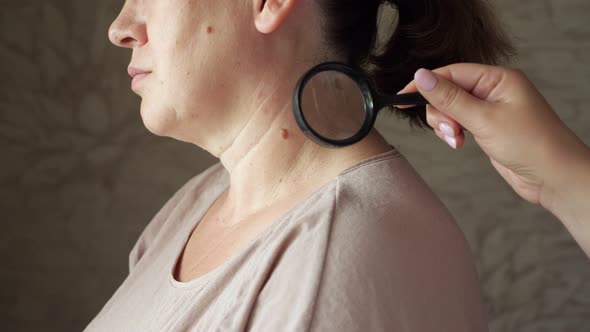 Dermatologist Examines a Mole on a Woman's Neck Using a Magnifying Glass alt