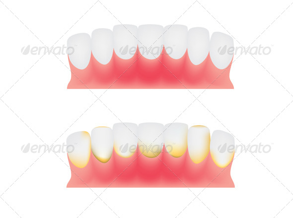 Teeth and Gums - Health/Medicine Conceptual