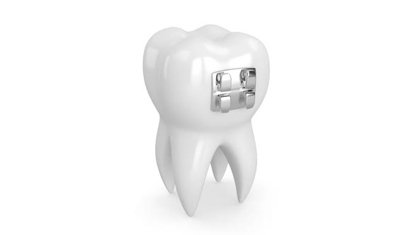 Tooth with dental orthodontic braces