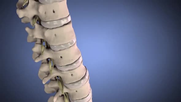 This is known as a slipped, herniated, or prolapsed disk. This causes pain and discomfort. alt