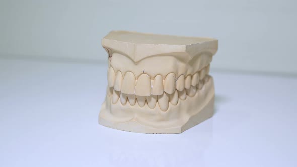 A custom dental mould alt