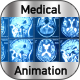 Magnetic Resonance Imaging  - VideoHive Item for Sale
