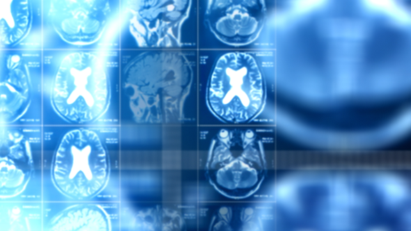 Magnetic Resonance Imaging  alt