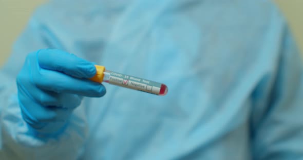 Coronavirus COVID-19 Infected Blood Sample in Doctor Scientist Hands. Epidemic and Virus Outbreak. alt