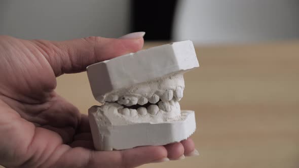 Gypsum Model Teeth Before Installing Bracket System alt