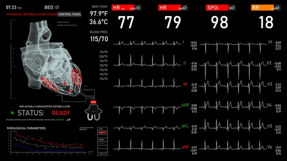 Cardiomonitor 4K (6in1)