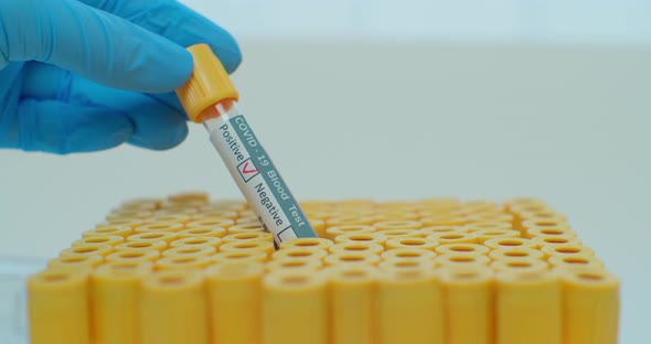 Researcher Hand Showing Tube, Positive Result of Blood Test for Coronavirus, Covid-2. alt