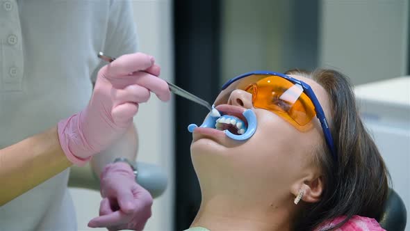 Dentist Prepares Patient For Teeth Whitening Procedure