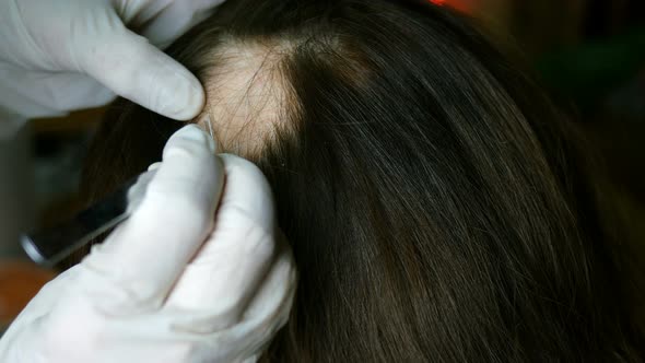 Doctor or Cosmetologist Does Inspection, Makes Procedures, Head of Woman alt