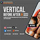 Vertical Before After Davinci Resolve - VideoHive Item for Sale