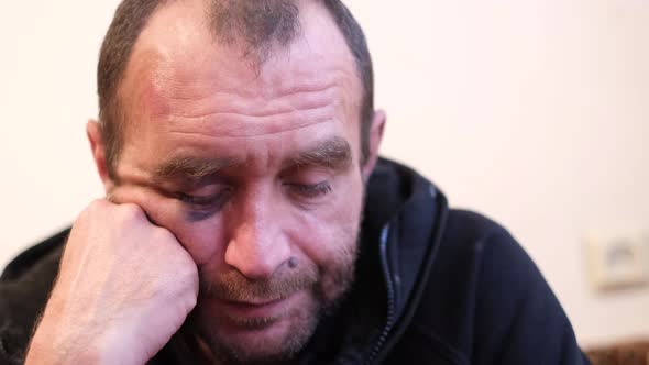 The Young Man is Depressed Has a Hangover Headache and Migraine Alcohol Abuse Drug alt