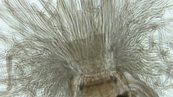 Worm Polychaeta of Family Terebellidae Under the Microscope Phylum Annelida alt