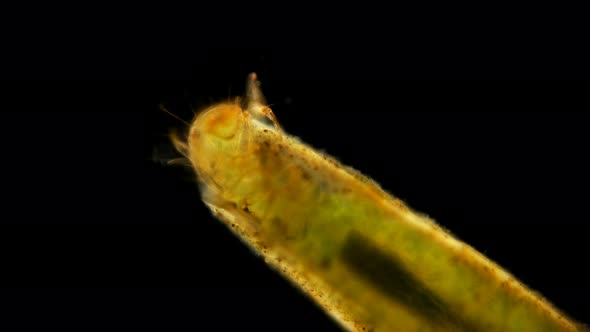 Trichoptera Larvae Under the Microscope alt