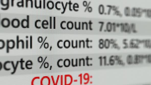 Coronavirus Covid19 Test with Negative Result on the Screen Page