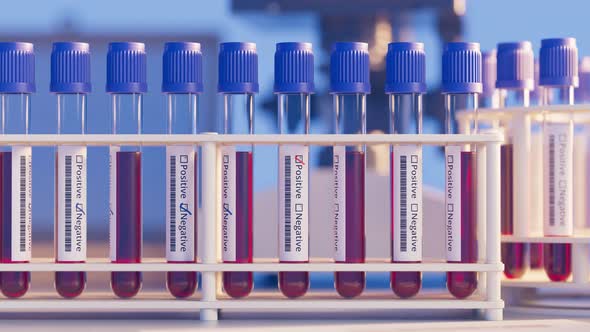 Blood samples for test in the laboratory. Positive probe. Laboratory. Lab 4k HD. alt