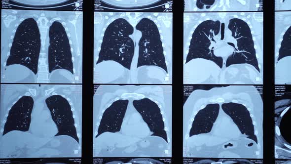 X-rays of light  alt