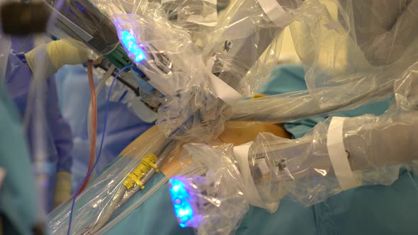 Surgery With Robot Arm