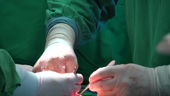Surgical Suture Or Stitches