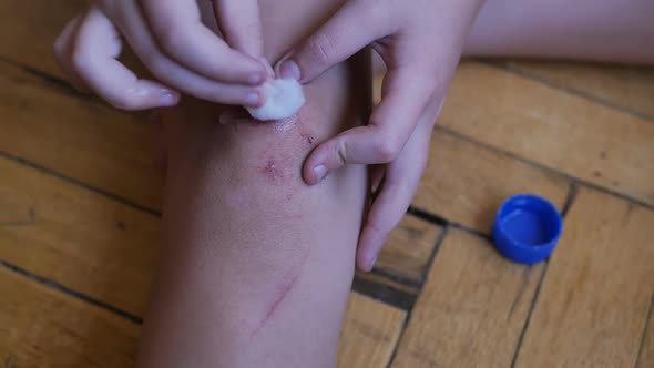 a Teenager Child Independently Treats a Wound on His Knee with a Cotton Swab and Hydrogen Peroxide