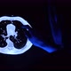 Doctor with a pen checking a tomography scan of lungs with cancer tumor - VideoHive Item for Sale