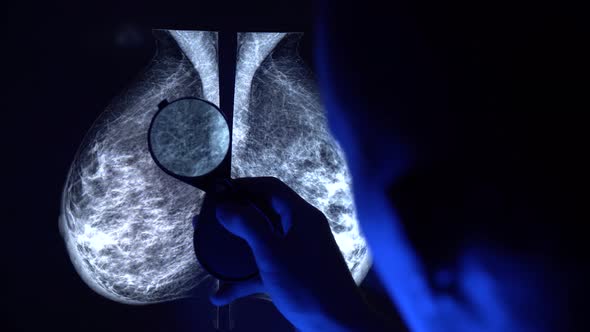 Doctor with magnifying glass checking mammogram x-ray. Mammography diagnostic