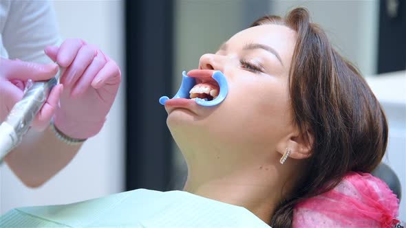 Dentist Prepares Woman Patient For Teeth Whitening Procedure In Dental Clinic.