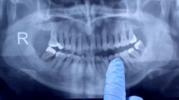Dental X Ray Close Up