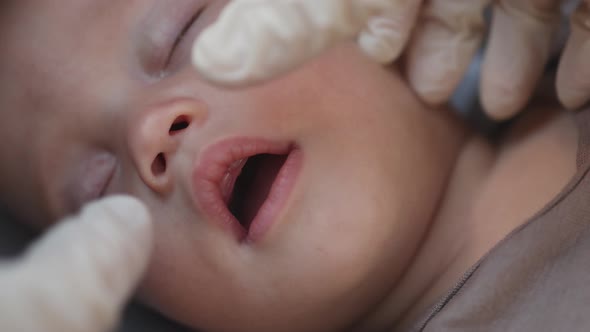 Doctors Hands Check Sleeping Baby Infant First Milk Teething in Gums Dentition alt