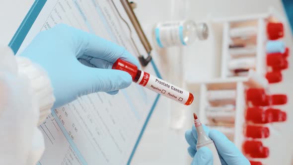 Vertical Video of Doctor Holds Hand Laboratory Blood Test Tube for Cancer Prostate alt