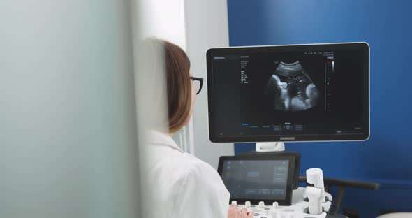 Back View of Young Female Caucasian Doctor Working on Modern Ultrasound alt